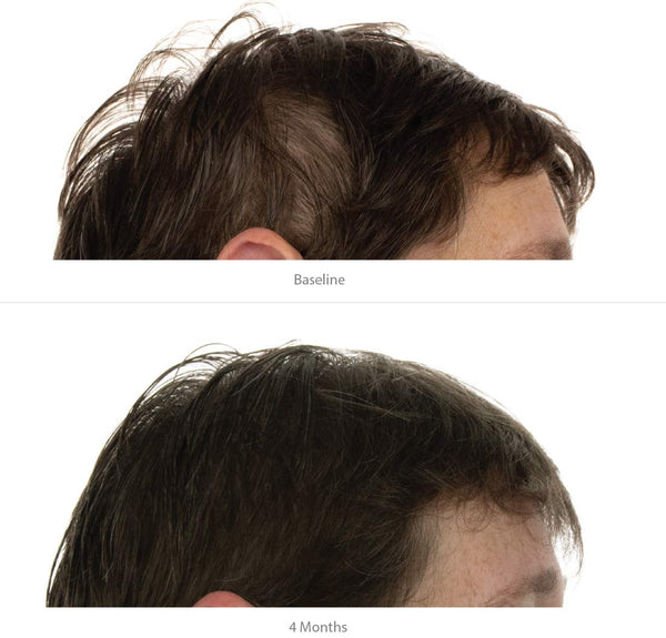 FOLIGAIN Hair Growth Shampoo + Conditioner Kit For Women - FOLIGAIN EUROPE